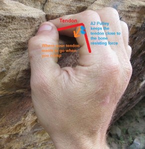 Significant load being put on the A2 pulley